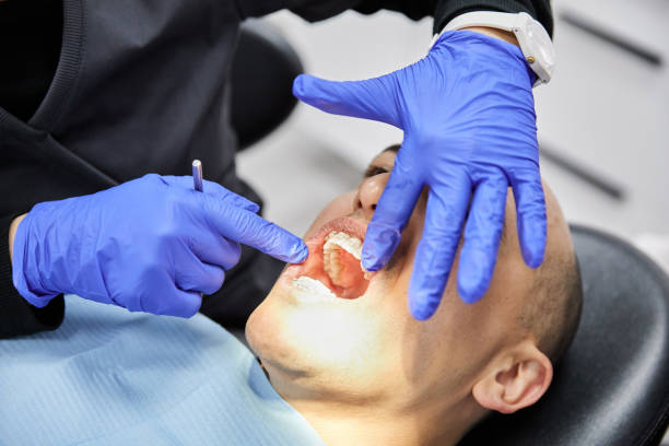 Best Emergency Dentist for Knocked-Out Tooth in Long Beach, MD